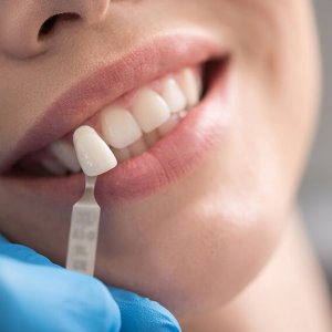 İmplant Yapım Aşamaları ve Süreci