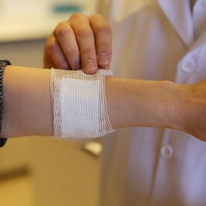 Kabuk Bağlayan Yara Kaç Günde İyileşir?