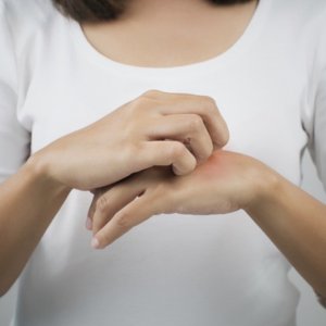 Yanık Izi Kalmaması Için Ne Yapmak Lazım