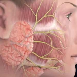 Yüz Felci Nedir? Yüz Felci Nedenleri Ve Tedavisi